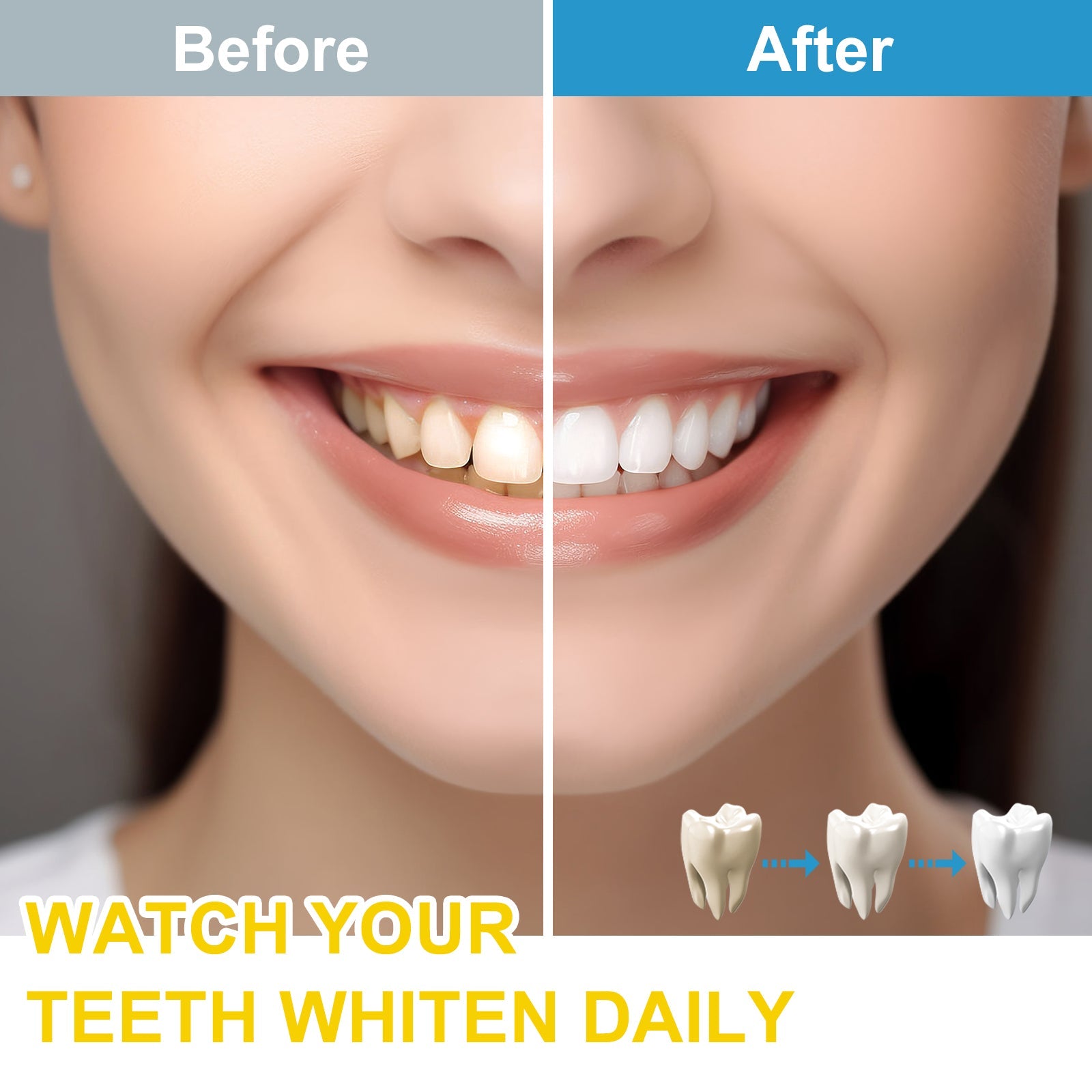 Whitening Kit for Sensitive Teeth Oral Care Includes LED Light 4 - Everbeaut