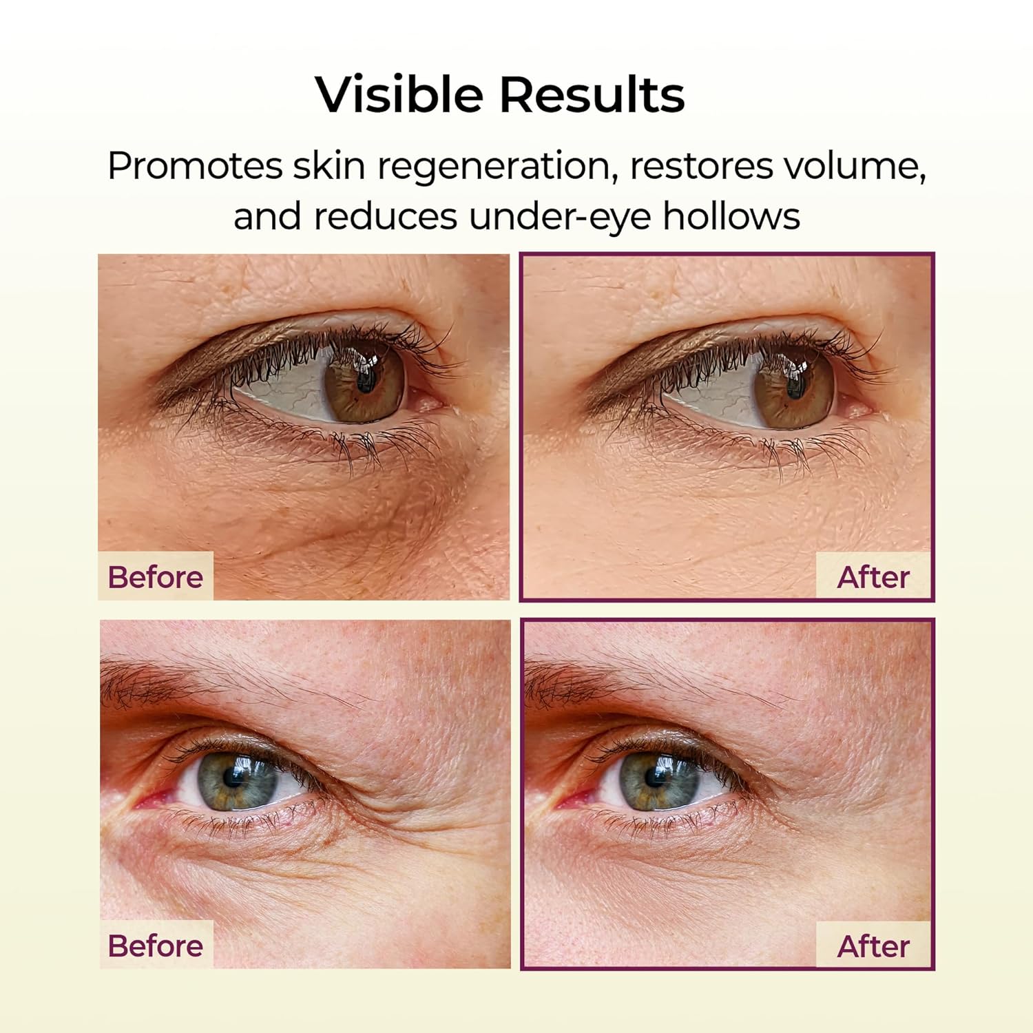 Dr. Melaxin Cemenrete™ Multi-Action Calcium Eye Balm Stick – Korean Anti-Aging Eye Care for Dark Circles, Fine Lines & Firming (9g)