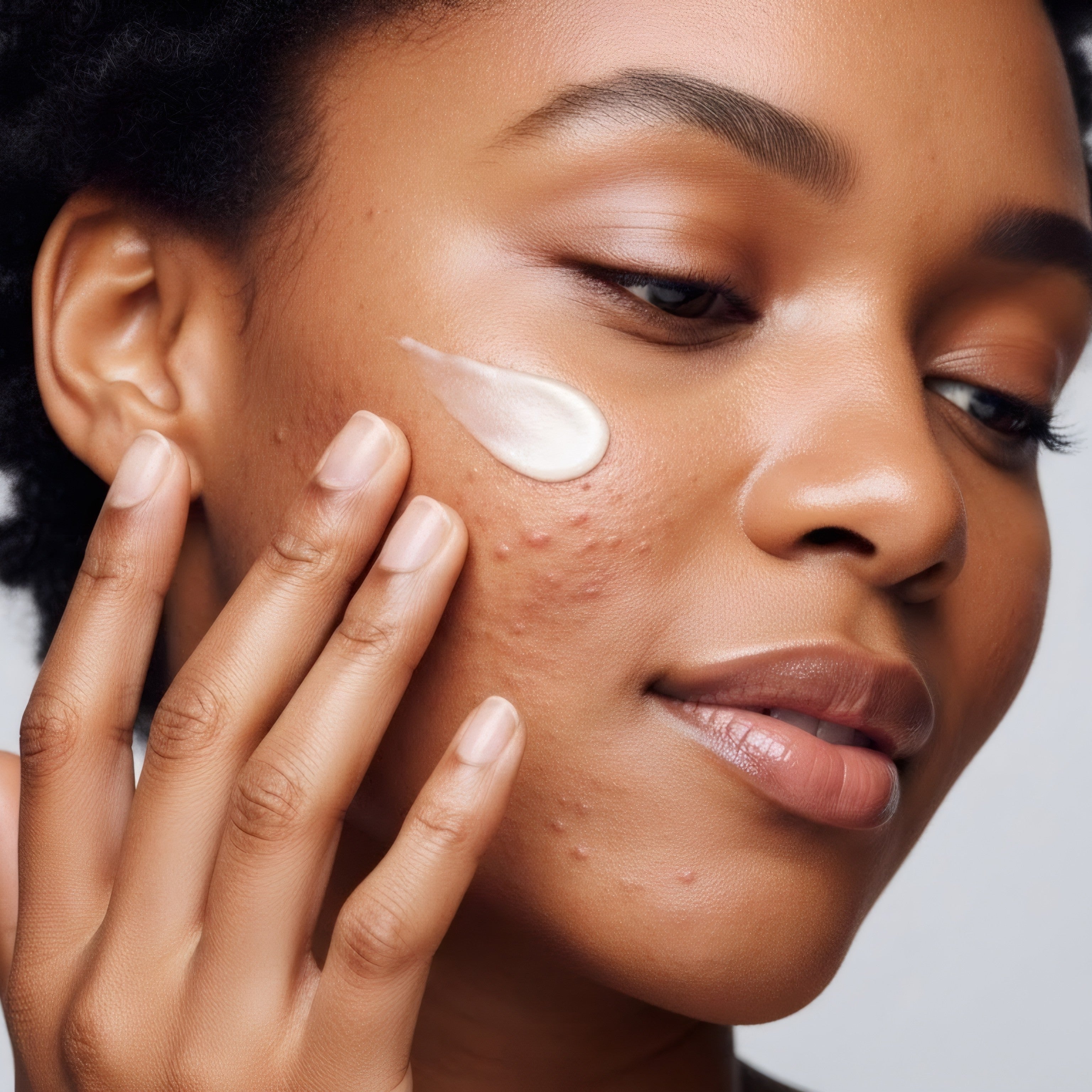 How to Get Rid of Acne Scars & Rough Skin Texture: The Complete 2026 Guide That Actually Works - Everbeaut