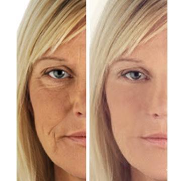 Age Perfect: Night Repair Cream + Vitamin C+ Serum - Everbeaut