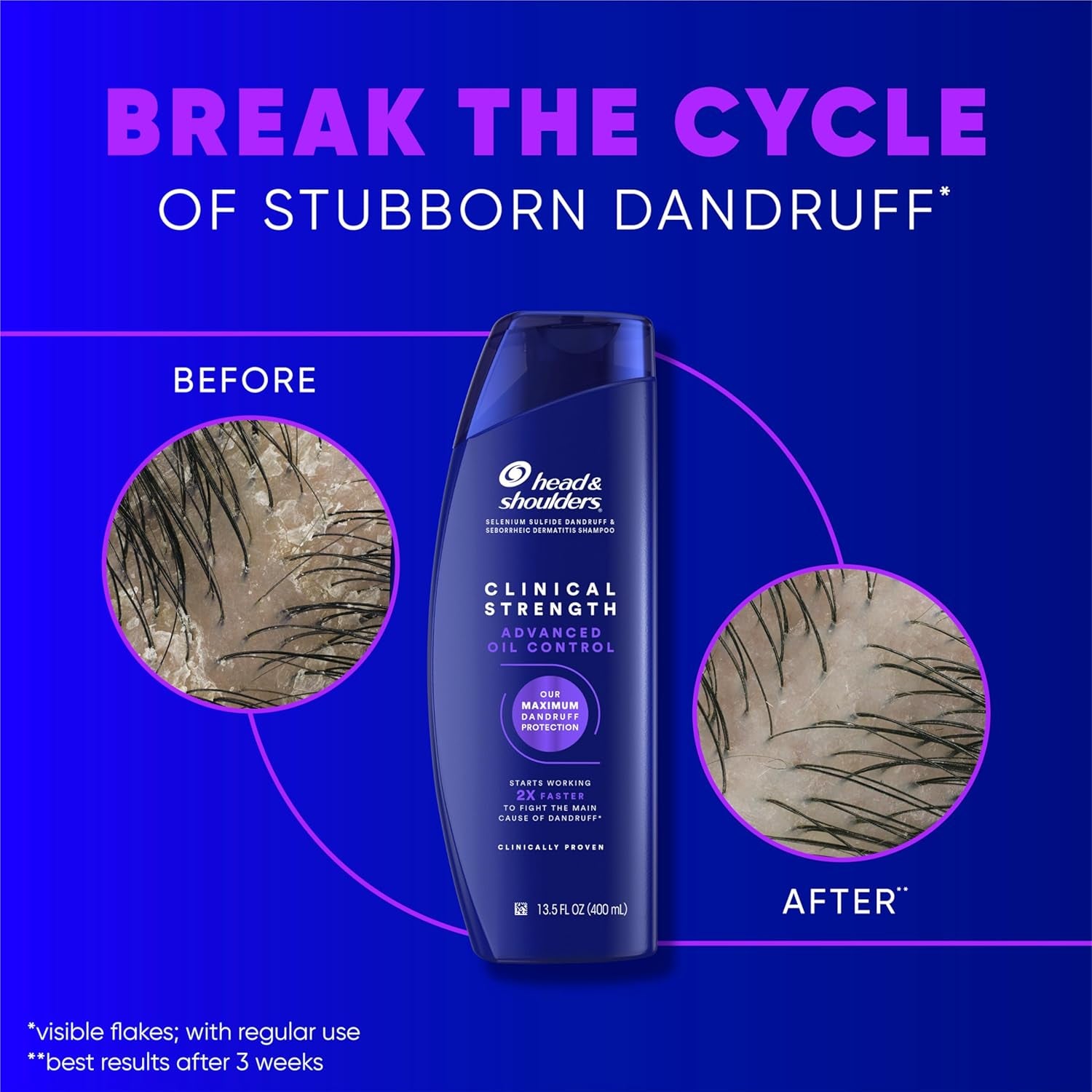 Head & Shoulders Clinical Strength Dandruff Shampoo – Selenium Sulfide Anti-Dandruff Formula for Severe Flaking & Itch Relief – Cooling Menthol – 13.5 fl. oz, 2-Pack – Premium Health & Beauty Product by Everbeaut.