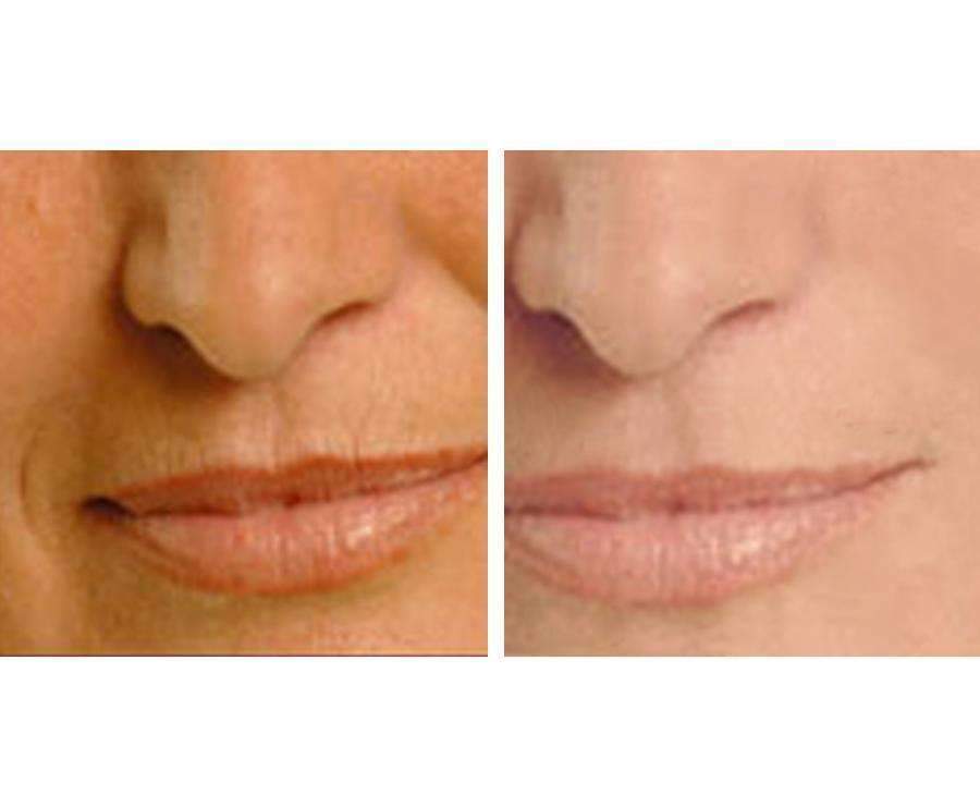 Age Perfect: Night Repair Cream + Vitamin C+ Serum - Everbeaut