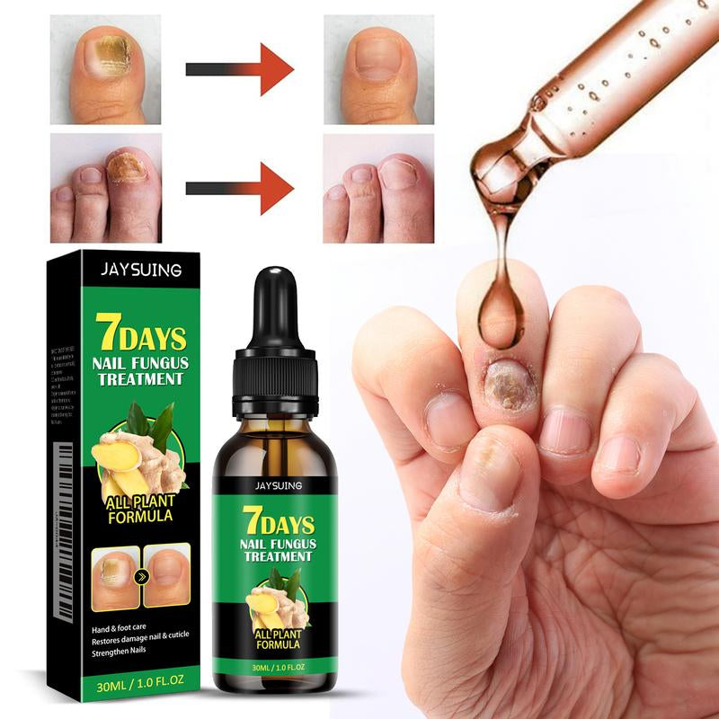 【TK SALES】JAYSUING Ginger Nail Care | Vitamin E and Plant Essential Oils for Nail Care | to Support Recovery from Tinea Onychia, Paronychia and Nail Deformity | Comfortable Nails and Nail Solutions Ginger Nails | Nail Rehabilitation